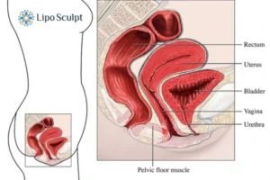 Treatment For A Leaky Bladder 2 How EM Chair treatment Borehamwood can help Leaky bladder issues. Read more now!